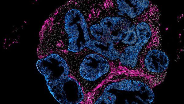تحولی در زیست‌فناوری: جایگزینی مدل‌های حیوانی با اندام‌واره‌های روده‌ای (Organoids) توسط استارتاپ Intero Biosystems