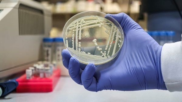 ظهور گونه‌های پان-مقاوم Candida auris؛ تهدیدی بیولوژیک با قابلیت تطبیق‌پذیری نگران‌کننده